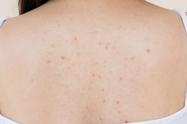 aHR0cHM6Ly9zLmlzYW5vb2suY29tL3dvLzAvdWQvMjgvMTQzOTY5L2lzYS5qcGc=