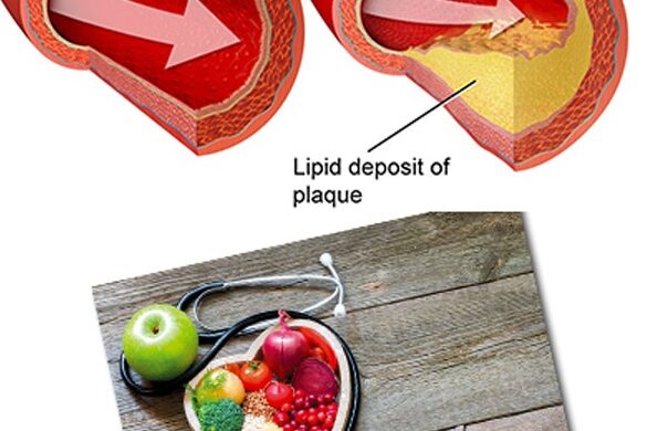 foodcleanoutarteries