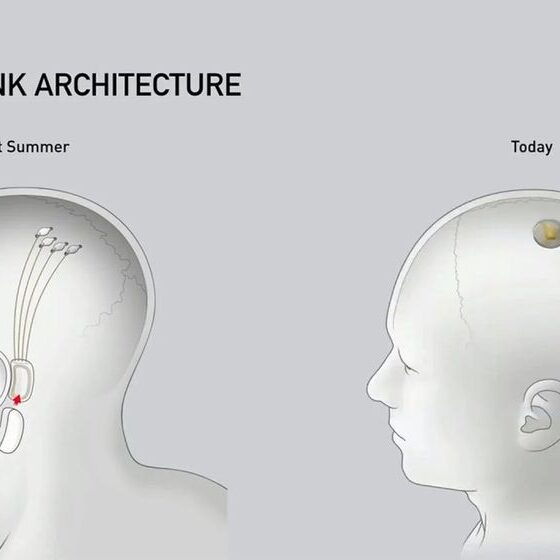 Neuralink