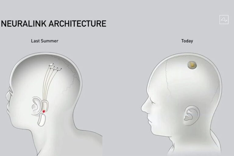 Neuralink