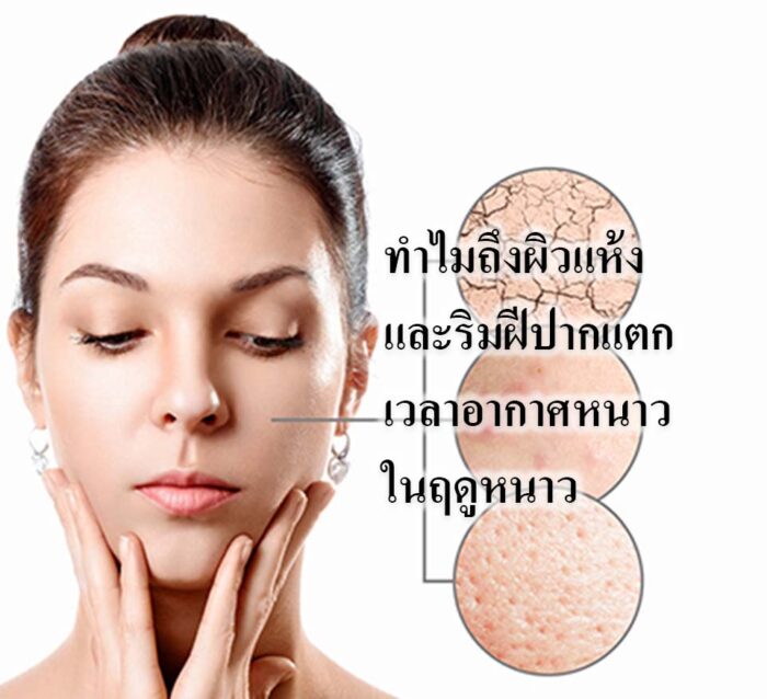 ทำไมถึงผิวแห้งและริมฝีปากแตกในเวลาอากาศหนาวในฤดูหนาว