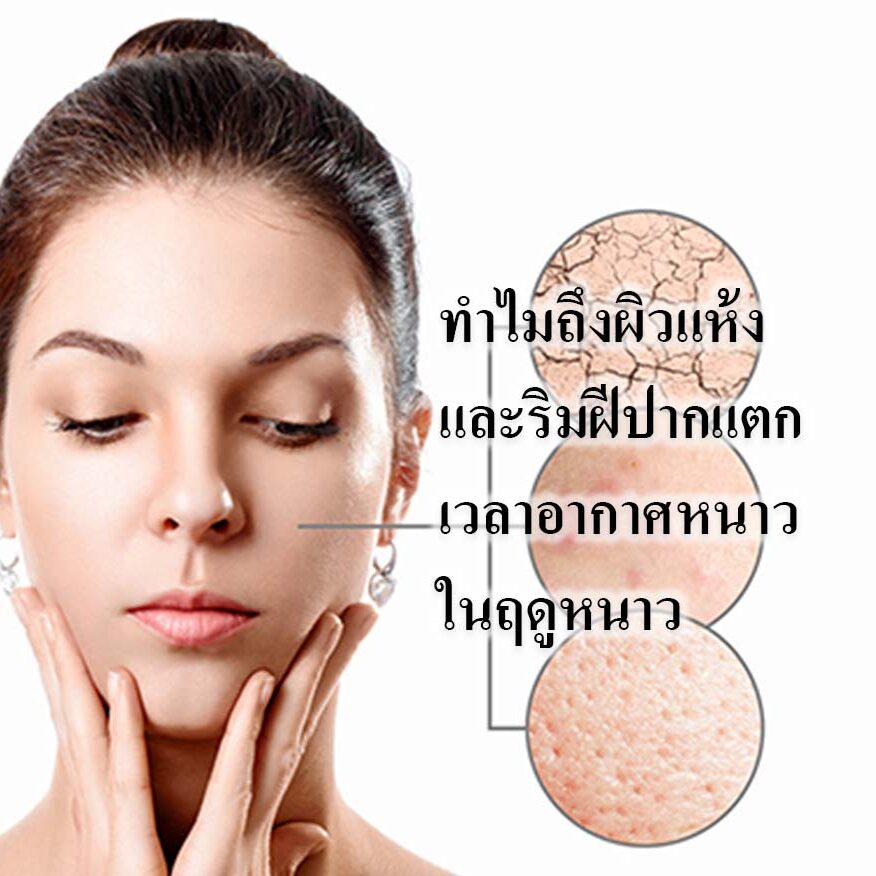 ทำไมถึงผิวแห้งและริมฝีปากแตกในเวลาอากาศหนาวในฤดูหนาว
